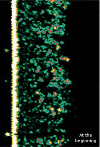 skin recorded by ultrasound skin recorded by ultrasound
